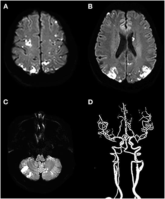 Andreas Charidimou MD, PhD tweet media