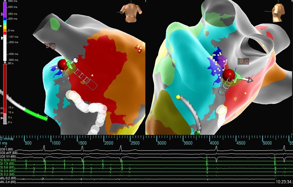 EP Mappers- DMV tweet media