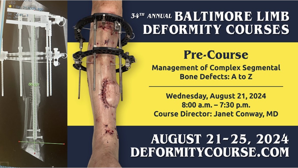 LimbLengthMD's tweet photo. Don't miss out on learning to manage complex segmental #BoneDefects & infected #nonunions from world-renowned experts in the field! Register for the #ICLL #BLDC Management of Complex Segmental Bone Defects: A to Z Pre-Course on August 21st at https://t.co/YvHfLEB3hi #OrthoTwitter https://t.co/HapJozWLWR