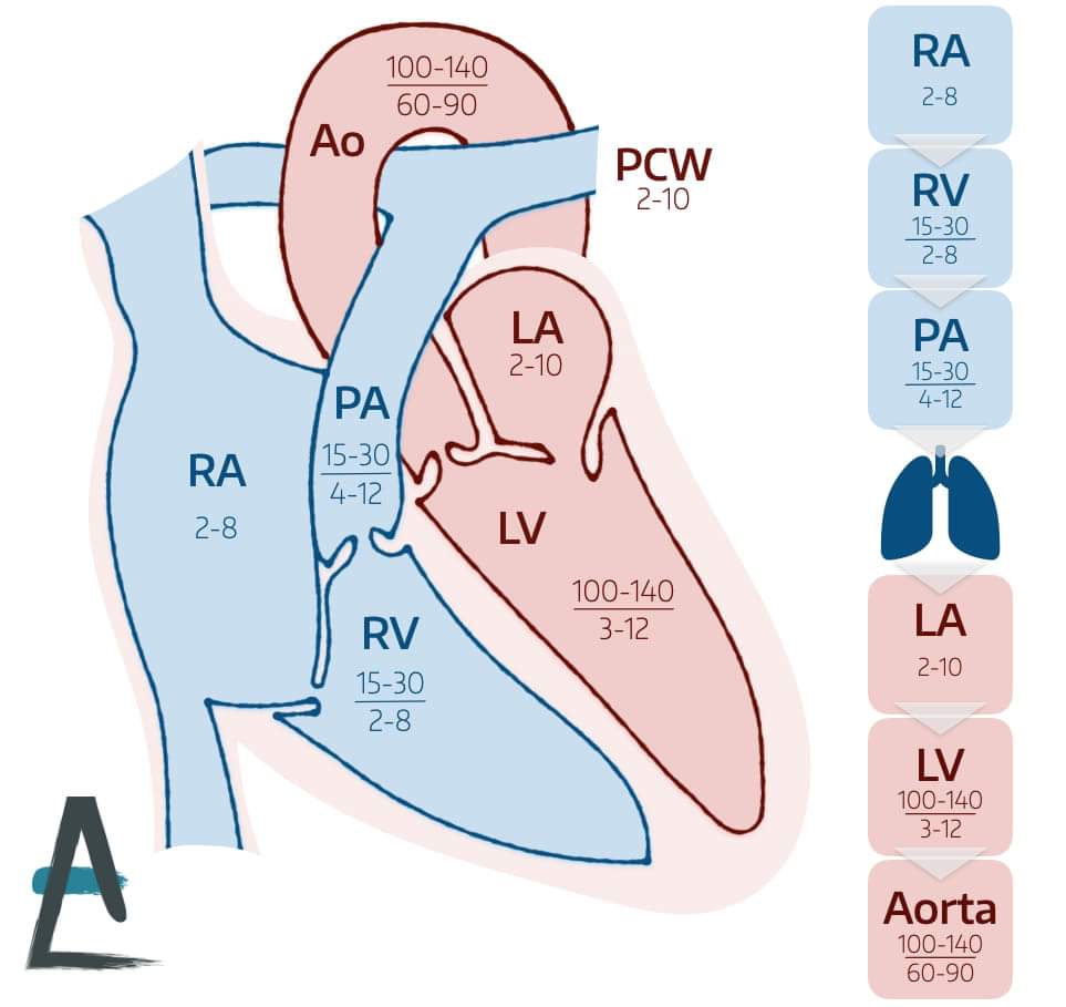 ZHeart11768530's tweet image. 🔴 Right Heart Catheterization Cheat Sheet: Interpretation of Pressures and Waveforms 

✅Normal Cardiac heamodynamic values
#RHC #Interpretation #Diagnosis #RightHeartCatheterization #CheatSheet #Waveforms #Cardiology #CardioTwitter #cardiology #CardioEd #cardiotwiteros