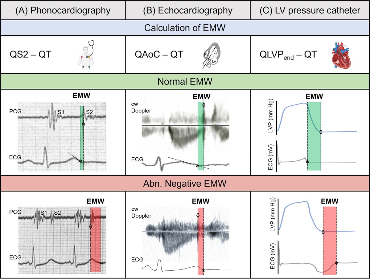 ZHeart11768530's tweet image. 🔴The Electromechanical Window for Arrhythmia-Risk Assessment #OpenAccess #2024Review @hrs_journal 

🔹heartrhythmjournal.com/article/S1547-…
#CardioTwitter #Cardiology #surgery #anesthesiology #MedEd  #CriticalCare #FOAMcc #FOAMed  #surgery #clinical #clinic #orthotwitter