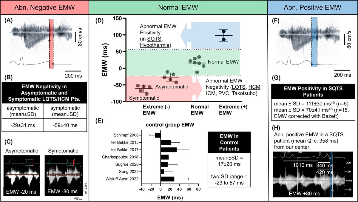 The Heart (@zheart11768530) on Twitter photo 🔴The Electromechanical Window for Arrhythmia-Risk Assessment #OpenAccess #2024Review <a href="/hrs_journal/">HeartRhythm</a>
🔹heartrhythmjournal.com/article/S1547-…
#CardioTwitter #Cardiology #surgery #anesthesiology #MedEd #CriticalCare #FOAMcc #FOAMed #surgery #clinical #clinic #orthotwitter 🔴The Electromechanical Window for Arrhythmia-Risk Assessment #OpenAccess #2024Review <a href="/hrs_journal/">HeartRhythm</a>
🔹heartrhythmjournal.com/article/S1547-…
#CardioTwitter #Cardiology #surgery #anesthesiology #MedEd #CriticalCare #FOAMcc #FOAMed #surgery #clinical #clinic #orthotwitter