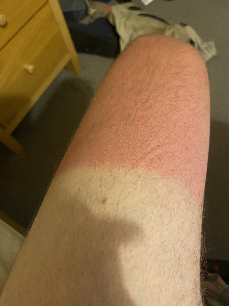 rae_stinker82's tweet photo. What’s it like being a greenkeeper in Orkney in summer I hear you ask?? Sunburnt on a Thursday…….wellies and survival suit on a Friday 🤦🏻‍♂️🌪️🌊💦🥶 https://t.co/uIzI7hs1qy
