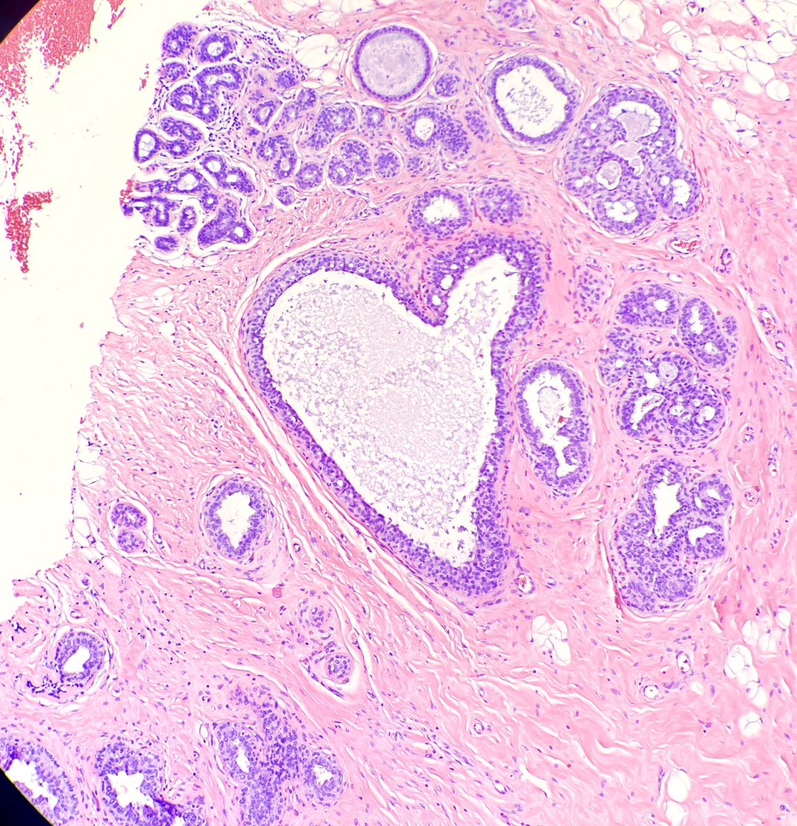 path_girl88's tweet photo. I love you too #breastpath #pathx #interestingfinds #PathTwitter https://t.co/BVI7yu40L9