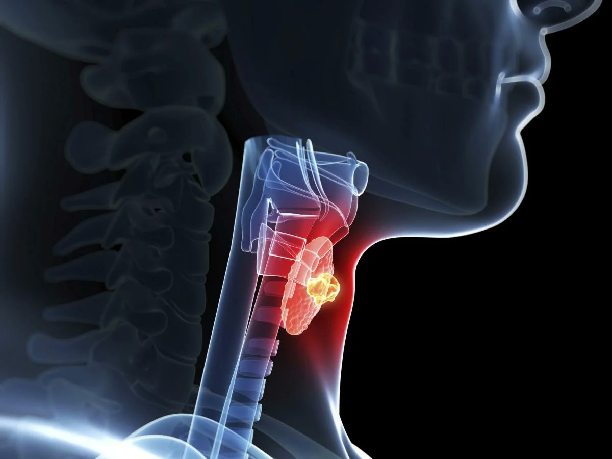 Zenfrog4's tweet photo. The thyroid is one of the most misunderstood organs in the body.

An over/underactive thyroid can completely tank your health.

So here's a full breakdown of a basic thyroid panel to help protect yours🧵