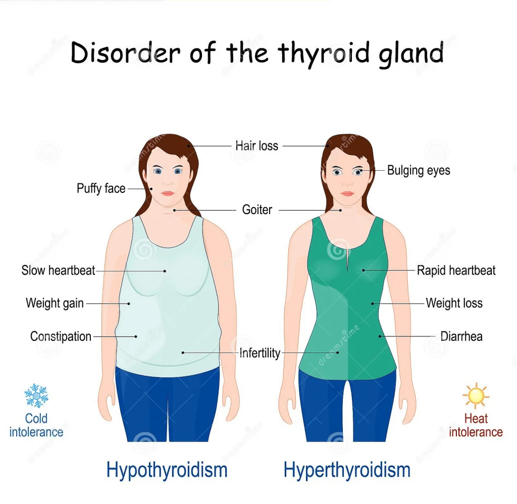 The Thyroid Is One Of The Most Misunderstood Organs In The Body An the-thyroid-is-one-of-the-most-misunderstood-organs-in-the-body-an