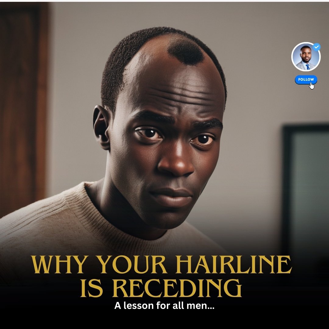 Are you worried about your hairline receding? It is nothing to be ...