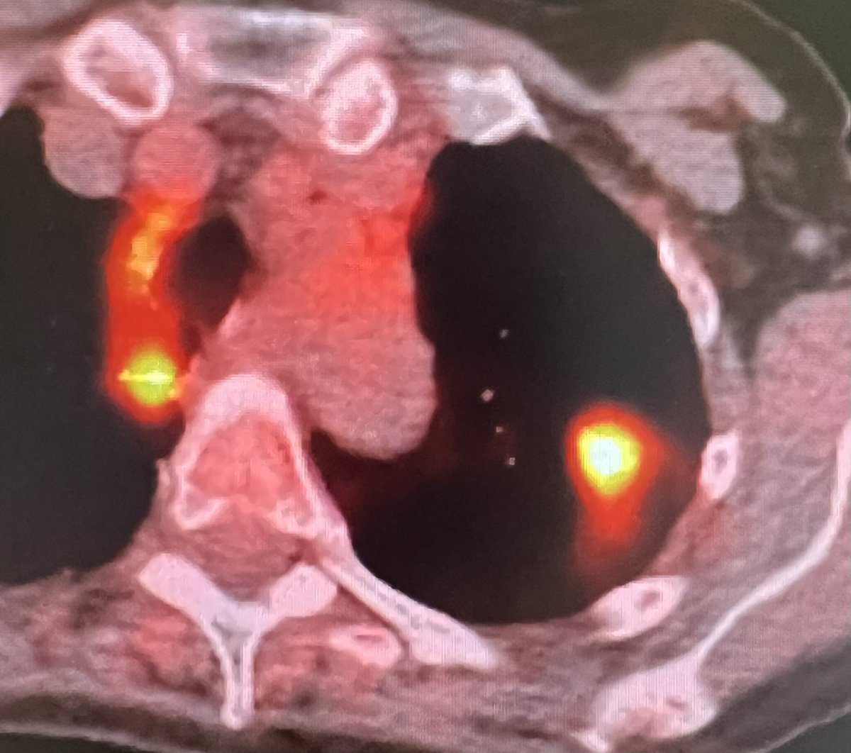 The Phlegmfighter tweet media