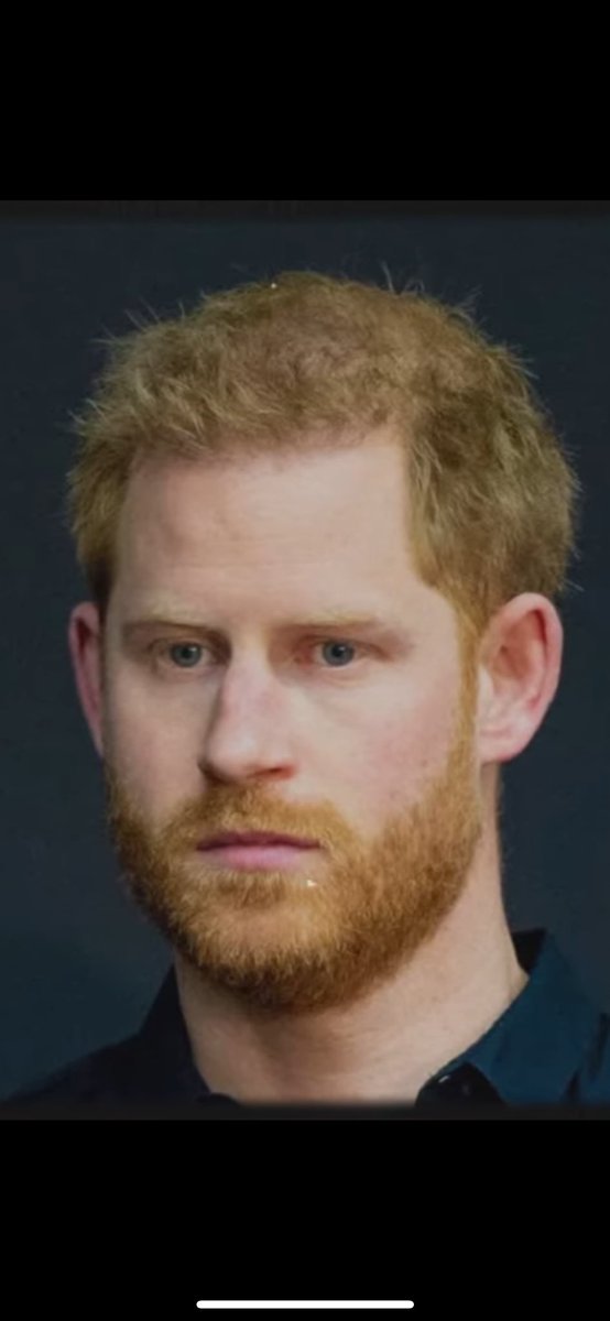0Rthebest91033's tweet photo. #HarryIsAUngreatfulBrats #Harol  #HarryATraitorAndALiar #HarryAndMeghanAreShameless #HarryDoesntDeserveThisAward #PrinceHarryDestroyedEvidence #PrinceHarryIsPathetic #PrinceHarryIsATraitor2HisCountryAndHisKing #PrinceHarryIsASpoiledBrat #HazbinANDhisDumbWife #DukeOfStupidity https://t.co/QwCsX9MjWg