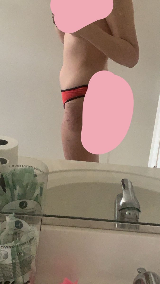 fukaoil's tweet photo. body check
tw sh on my legs https://t.co/9Qny7lLb5j