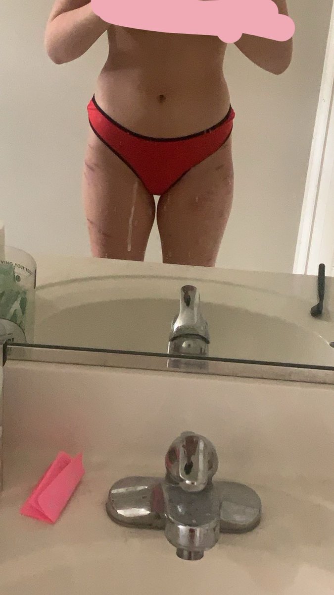 fukaoil's tweet photo. body check
tw sh on my legs https://t.co/9Qny7lLb5j