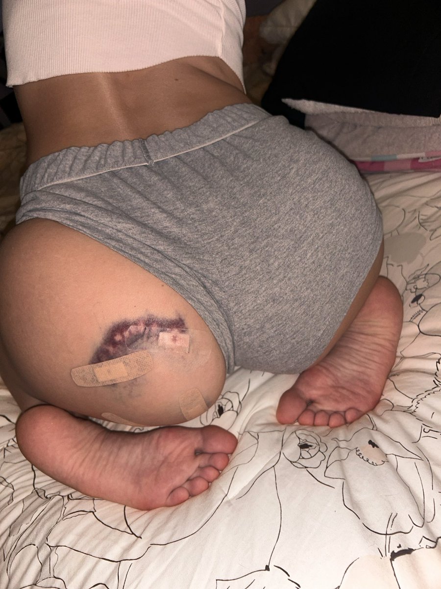 CutieeKayy69's tweet photo. Apple bottom make ‘em wanna bite #pitbull #dogbite https://t.co/1YohVu1I3d