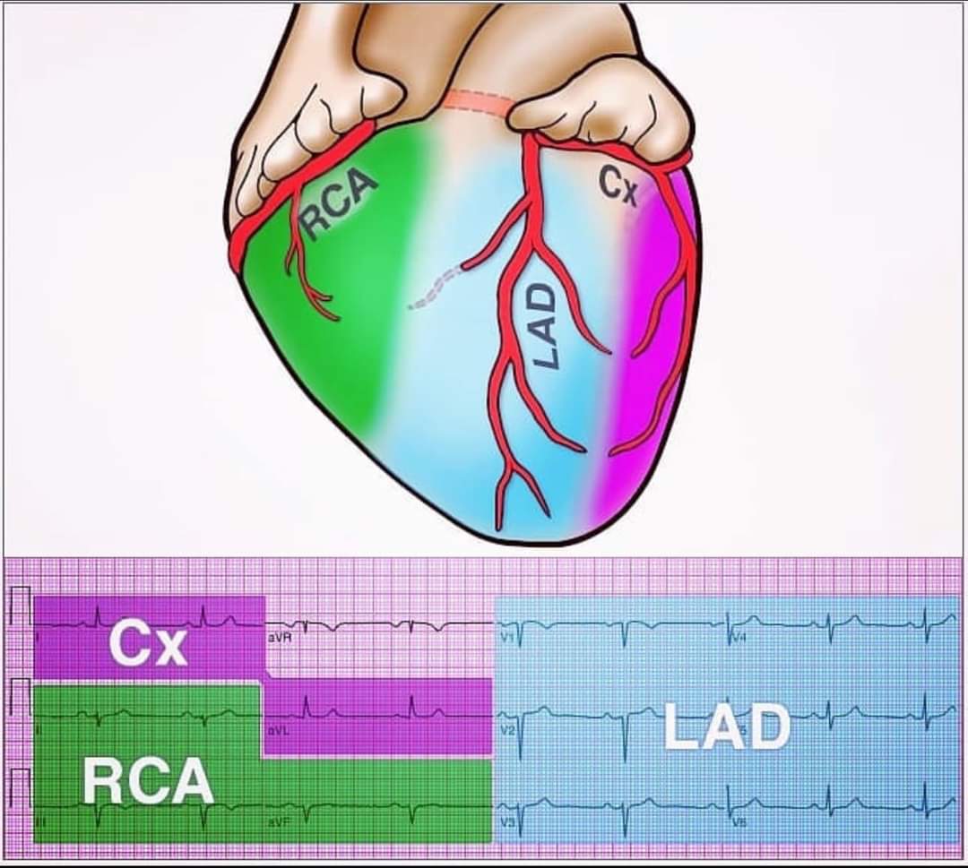 Coronary artery territory on ECG.