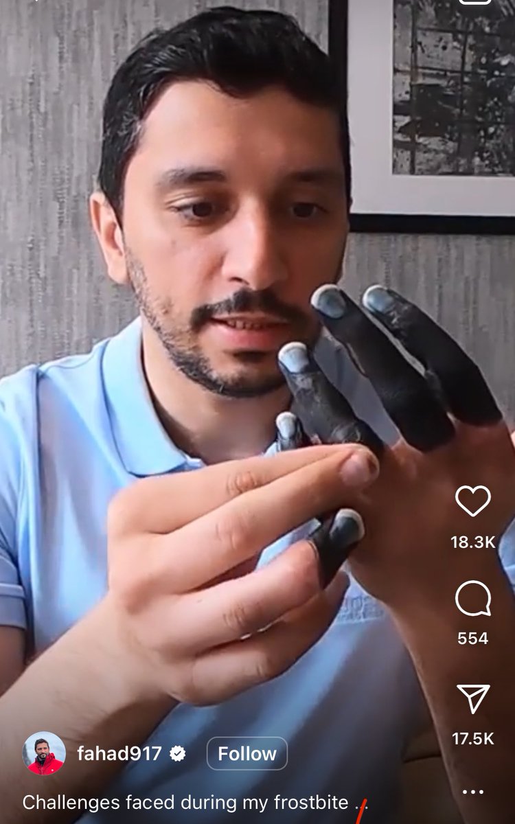 Ahmed Abdelhalim (@mdahmed_halim95) on Twitter photo I was truly amazed when I read about <a href="/Fahadbadar/">فهد بادار Fahad Badar</a> , a mountain climber who lost his fingers after 20 hours of non-stop climbing. Despite this, he conquered Vinson, the coldest mountain on Earth. Really a remarkable and great example of perseverance toward one's goals.
#MedTwitter I was truly amazed when I read about <a href="/Fahadbadar/">فهد بادار Fahad Badar</a> , a mountain climber who lost his fingers after 20 hours of non-stop climbing. Despite this, he conquered Vinson, the coldest mountain on Earth. Really a remarkable and great example of perseverance toward one's goals.
#MedTwitter
