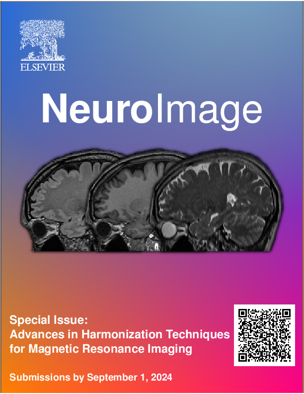 ICYMI: NeuroImage Special Issue - Advances in Harmonization Techniques for MRI ✨