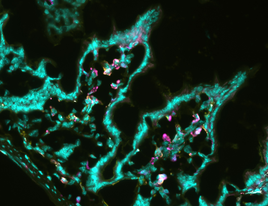 SciImmunology's tweet photo. Long-lived effector cells in mice are more flexible than suspected, able to enter non-lymphoid tissue and join the T resident memory cell pool. @CFI_UMN

Read more in Science #Immunology: https://t.co/xSdo8Q1gqI https://t.co/PPGbAWz1KL