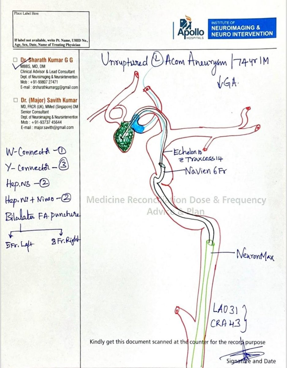 SharathKumarGG7's tweet image. Typical case of Balloon assisted coiling for an unruptured Acom artery aneurysm in an elderly gentleman @ApolloKarnataka @SavithKumarINR  #BrainAneurysm #Endovascular #Coiling #Balloon #Neurointervention #Aneurysm #Neurosurgery #Neurology #Neuroradiology #Brain #AneurysmSurvivor