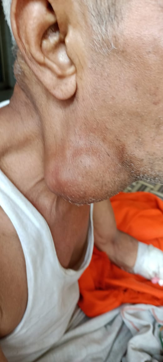 Bharat24588032's tweet photo. #Need_help #help
#Ghaziabad Pratap vihar ke siddh Shiv Mandir mein ek Rajesh shrma naam ek vyakti pde huye h jo bs soye rhte hai .Shayad cancer ki problem hai . Unki family mein koi unhen dekhne wala nhi h .
Mob- 7827171710
Please help 🙏
@AskRoushan
@PrashantSahyog https://t.co/bB9313tR0L