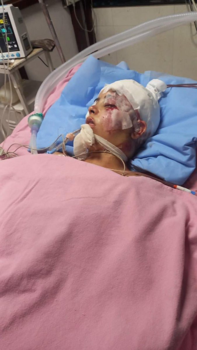 rohitbhatkp's tweet photo. Accidental case of Ms. Pooja Koul 
D/0 Ramesh koul 
R/0 Jagti Nagrota who condition is critical, admitted in GMC hospital Jammu .

Account No : 0021040100047881
IFSC Code :JAKA0LUXURY
JKBANK
NAME : Ramesh Kumar Koul

*Ramesh Kumar Koul Father of Pooja Koul : 8899387435*. https://t.co/HUe7Vn94bx