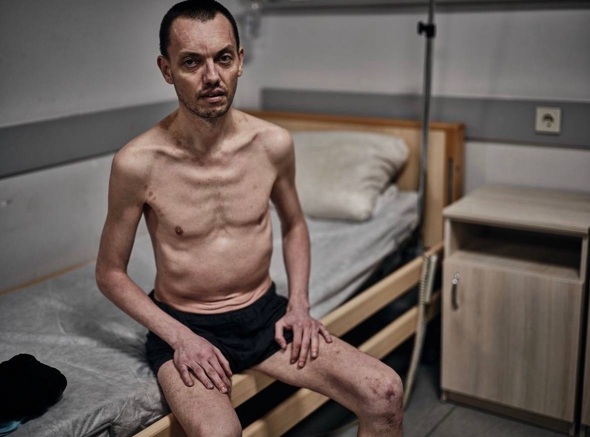 UkrainianAna's tweet image. Question...
Is there any talk in the Western media about the fact that about 80% of our people look like this after Russian captivity?
Because I do not see it.
Is this the new normal? Not worth an outrage? Not worth a mention?
Devastating.