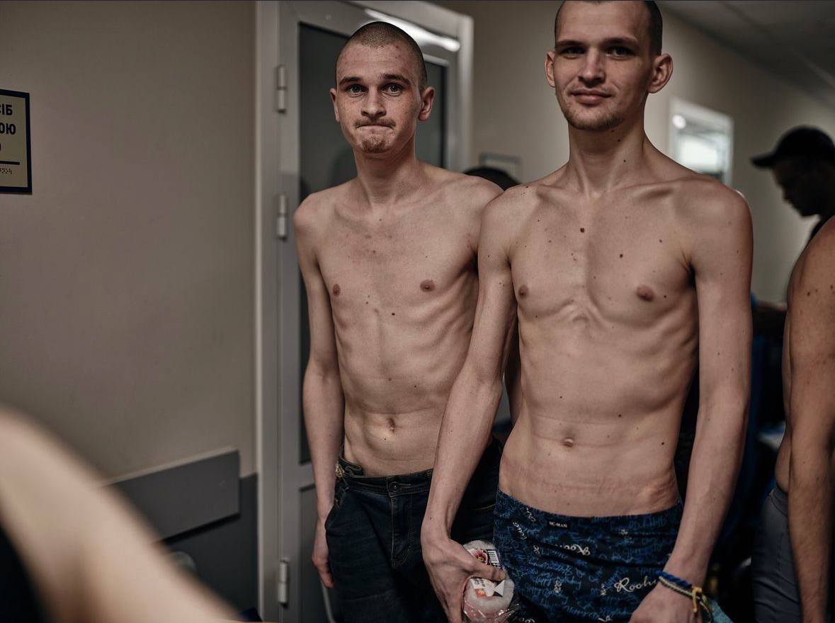 UkrainianAna's tweet image. Question...
Is there any talk in the Western media about the fact that about 80% of our people look like this after Russian captivity?
Because I do not see it.
Is this the new normal? Not worth an outrage? Not worth a mention?
Devastating.