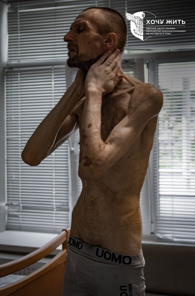 UkrainianAna's tweet image. Question...
Is there any talk in the Western media about the fact that about 80% of our people look like this after Russian captivity?
Because I do not see it.
Is this the new normal? Not worth an outrage? Not worth a mention?
Devastating.