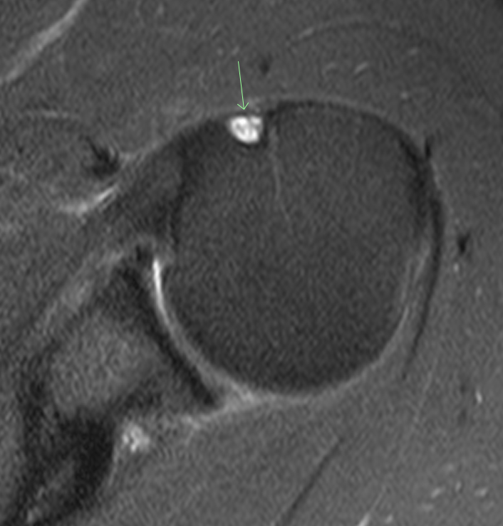 Alabama Orthopedic Imaging tweet media