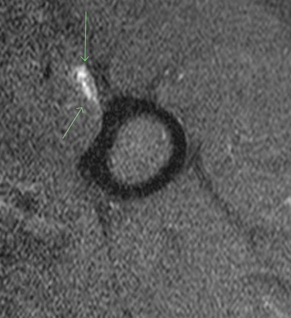 Alabama Orthopedic Imaging tweet media