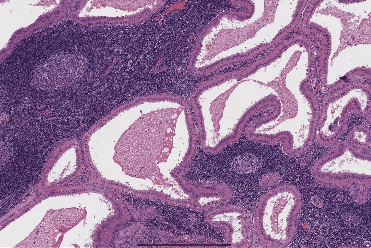 histohandbook's tweet photo. How would you describe what you are seeing? #histohandbook #pathology https://t.co/6qeNOEUeZa