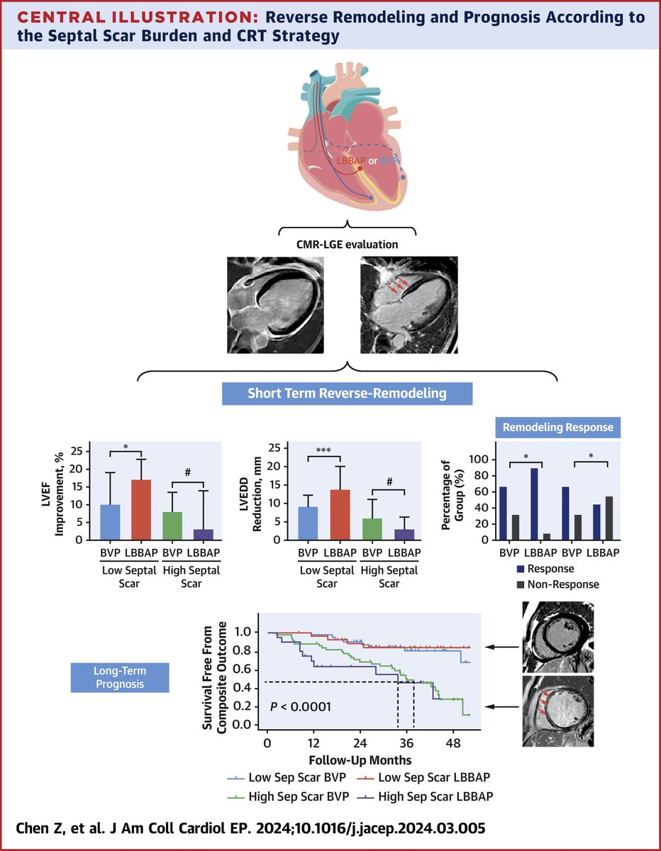 Margarida Pujol Lopez (@margaridapujol) on Twitter photo A Comparison of the Association of Septal Scar Burden on Responses to LBBAP-CRT and BVP-CRT
sciencedirect.com/science/articl…
High septal scar burden was associated with poor clinical prognosis independent of CRT methods
<a href="/JACCJournals/">JACC Journals</a> A Comparison of the Association of Septal Scar Burden on Responses to LBBAP-CRT and BVP-CRT
sciencedirect.com/science/articl…
High septal scar burden was associated with poor clinical prognosis independent of CRT methods
<a href="/JACCJournals/">JACC Journals</a>