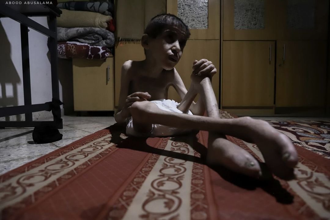 Bahaa Alnimr, 15. 

Gaza