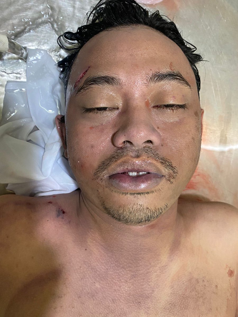 Telah ditemukan sesosok Jasad mengapung di perairan sungai Martapura tepatnya di ppi(perikanan)Rk ilir,tuk identitas negatif ada jika mengetahui atau ada warga yg kehilangan pihak keluarga bisa merapat ke Rsud ulin banjarmasin kamar jenazah atau bisa menghubungi ke satpolairud