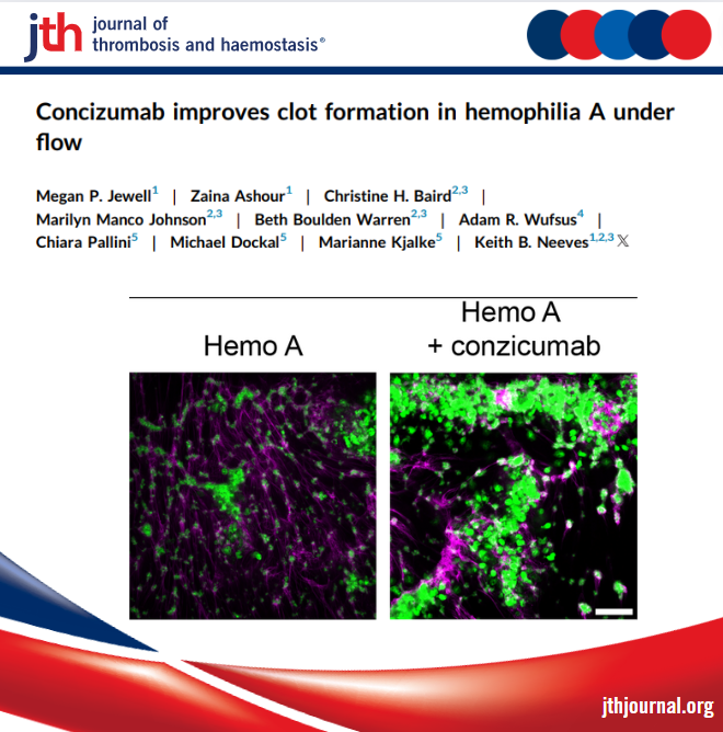 JTH (@jthjournal) on Twitter photo Concizumab enhanced clot formation under flow under hemophilia A conditions, highlighting a yet underrecognized role of concizumab on the platelet-dependent part of the hemostatic process.
<a href="/NeevesLab/">Neeves Lab</a>
jthjournal.org/article/S1538-… Concizumab enhanced clot formation under flow under hemophilia A conditions, highlighting a yet underrecognized role of concizumab on the platelet-dependent part of the hemostatic process.
<a href="/NeevesLab/">Neeves Lab</a>
jthjournal.org/article/S1538-…