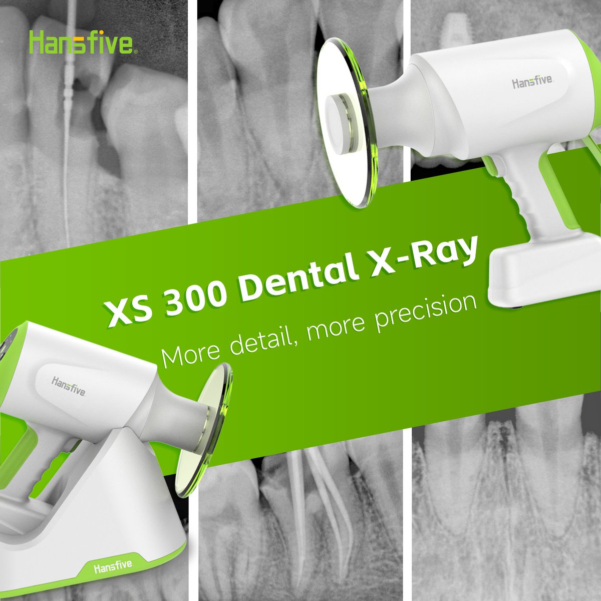 HanSfivedental's tweet image. 🔰𝐌𝐨𝐫𝐞 𝐝𝐞𝐭𝐚𝐢𝐥, 𝐦𝐨𝐫𝐞 𝐩𝐫𝐞𝐜𝐢𝐬𝐢𝐨𝐧
Hansfive XS 300 Dental X-RAY is ready to elevate your dental practice.

#hansfive #dentalxray