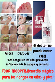 AbuSayed23456's tweet photo. You will get the product from us at the cheapest price .
Here you will get 50% discount which no one else can give you . This medicine is 100% guaranteed to cure all types of foot problems. Those who want to take it can knock on the link or my  Gmail .
https://t.co/pMkzgSRnel https://t.co/wAt32QxdFS