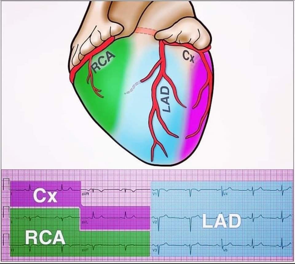 Coronary Arteries And Ecg Leads