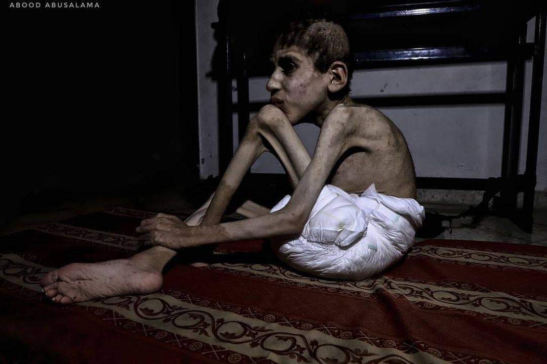 NosaybaYousef's tweet photo. "وبلغت القلوب الحناجر" ..
اللَّهُمَّ غوثك، فإنا لا نظن بك إلا الخير.

#شمال_غرة_يموت_جوعًا https://t.co/USb9dmPThS