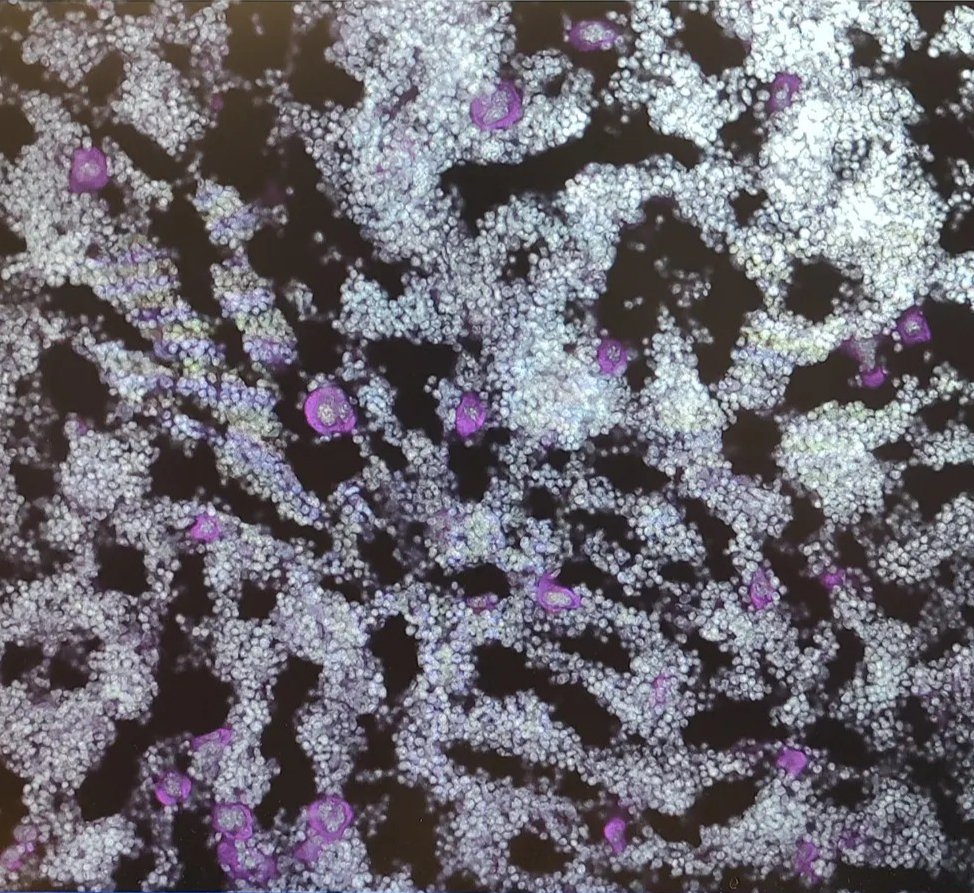 Imagining these beautiful megakaryocytes (🟣) in the bone marrow 🔬🐁