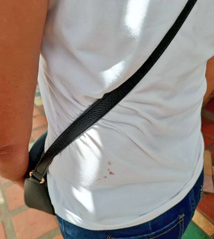 #ALERTA <a href="/FundehullanVzla/">Fundehullan Vzla</a>, La Ciudadana Sandra alizo fue agredida y herida con un arma blanca por jefa de ubche en el simulacro electoral, en san Fernando de Apure, en el centro de votación la Clarisa de Trejo.