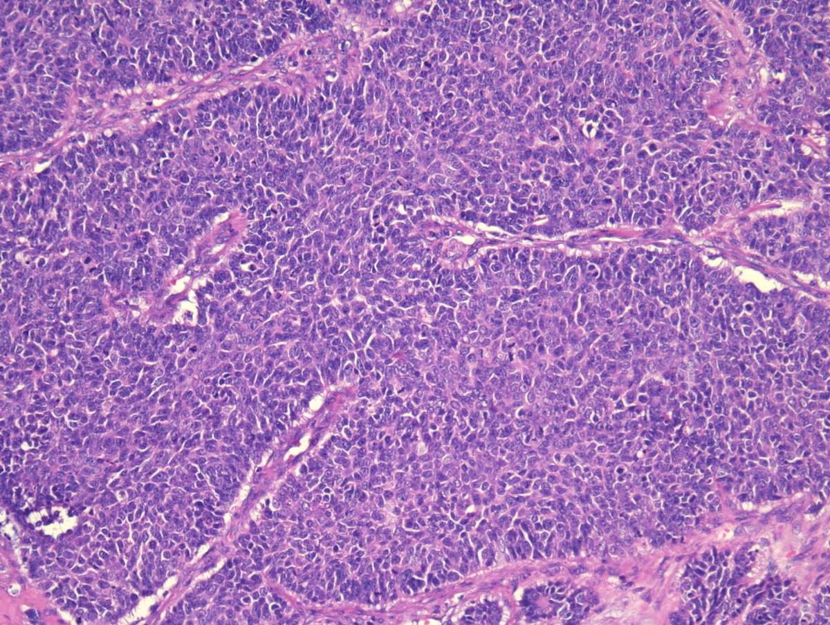 Miruna Popescu, MD tweet media