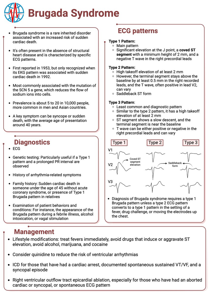 #Brugadasyndrome in a nutshell!