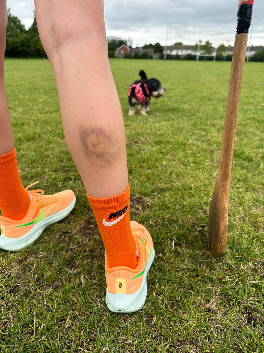 JadeODoherty's tweet photo. @Nike Nike runners ✅ Nike socks ✅ Nike bruise ✅ #JustDoIt https://t.co/xvQ1DH8wOu