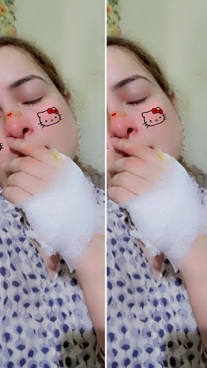Happened my hand blood test to willing busy at work my kitchen 🙃.  #BreakingNews #deaf #sad