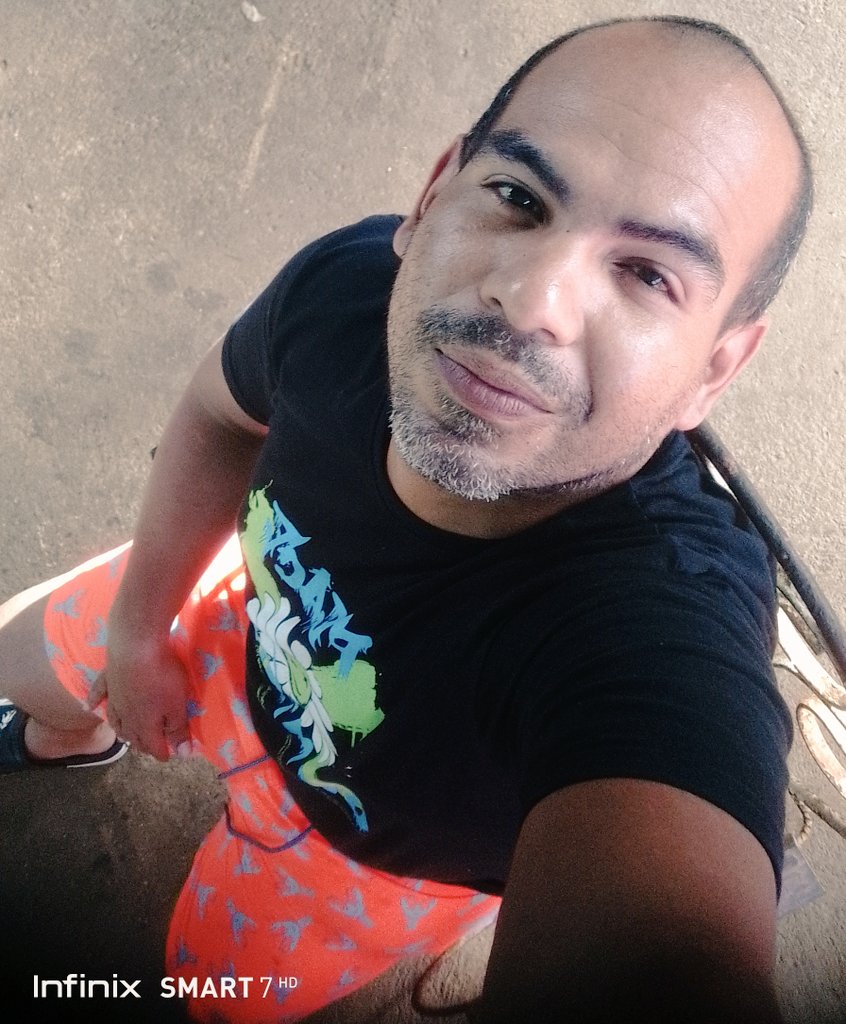 Hola! Con un ojo hinchado pero tranquilo. Le juro que no le negué nada a nadie y a mujer embarazada menos.