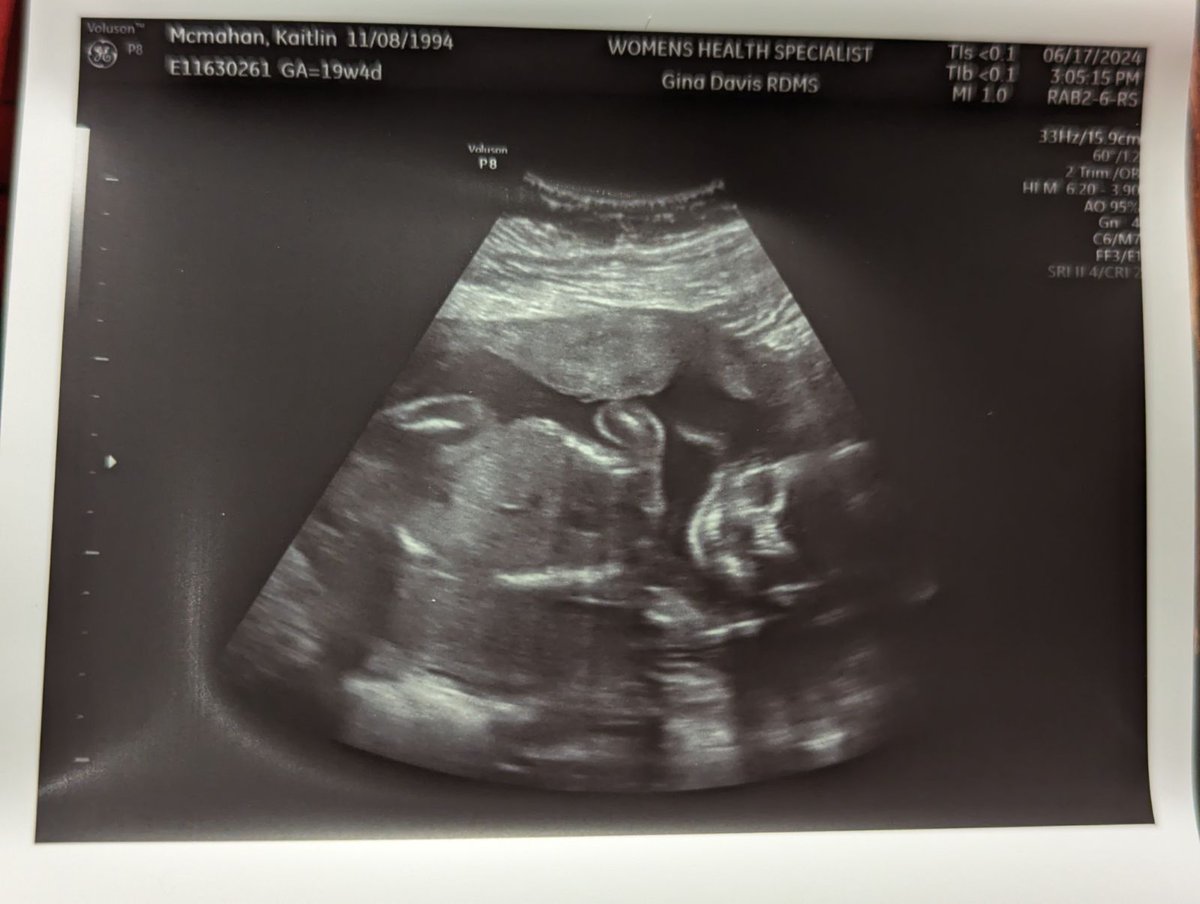_Arthanau's tweet photo. Yo I'm going to be a dad. That's cool as shit. https://t.co/iylNBM3zZb