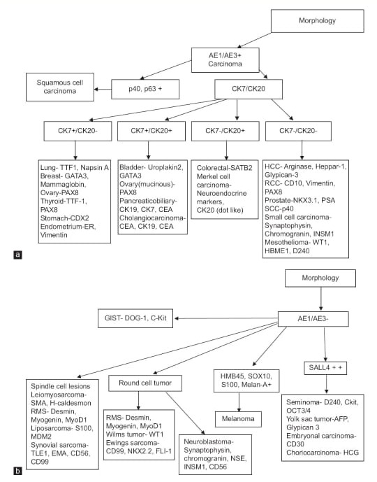 Cancer Research, Statistics and Treatment (@crstonline) on Twitter photo Dr. Neha Singh and team present an audit of liver metastatic tumors, highlighting adenocarcinomas often originating from the pancreaticobiliary tract, as predominant. Read here: bit.ly/3VJwWPk #CRST #MedTwitter #LiverMetastasis #Oncology #CancerResearch Dr. Neha Singh and team present an audit of liver metastatic tumors, highlighting adenocarcinomas often originating from the pancreaticobiliary tract, as predominant. Read here: bit.ly/3VJwWPk #CRST #MedTwitter #LiverMetastasis #Oncology #CancerResearch