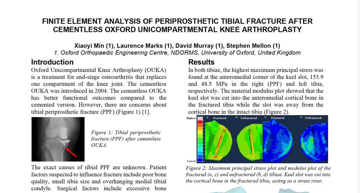 OOEC (@ooec_oxford) on Twitter photo After @DrJackTu's trip to #Eindhoven last week, we are pleased that <a href="/xiaoyi_min0605/">Xiaoyi Min</a> is at #ESB2024 in #Edinburgh presenting her work on 'FEA of periprosthetic tibial fracture after cementless Oxford UKA (poster ID no 462) <a href="/DrStephenMellon/">Stephen Mellon</a> <a href="/laurencemarks64/">LaurenceMarks</a> #FEA #OxfordKnee <a href="/ndorms/">NDORMS</a> After @DrJackTu's trip to #Eindhoven last week, we are pleased that <a href="/xiaoyi_min0605/">Xiaoyi Min</a> is at #ESB2024 in #Edinburgh presenting her work on 'FEA of periprosthetic tibial fracture after cementless Oxford UKA (poster ID no 462) <a href="/DrStephenMellon/">Stephen Mellon</a> <a href="/laurencemarks64/">LaurenceMarks</a> #FEA #OxfordKnee <a href="/ndorms/">NDORMS</a>