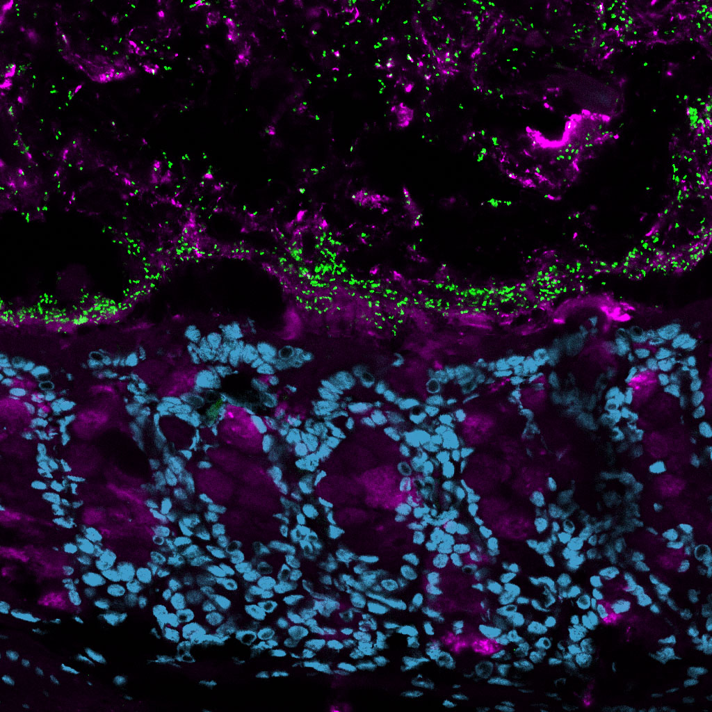 Happy #MucusMonday and #MicroscopyMonday, featuring bacteria (green) in mucus (purple) in the colon.

#MucinMonday #sciart #pathart #bioart #histoart #microscopy #intestine #colon