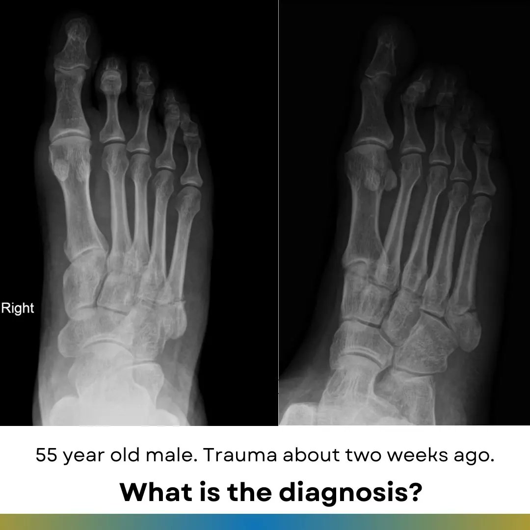 Orthopaedic Tutorials tweet media