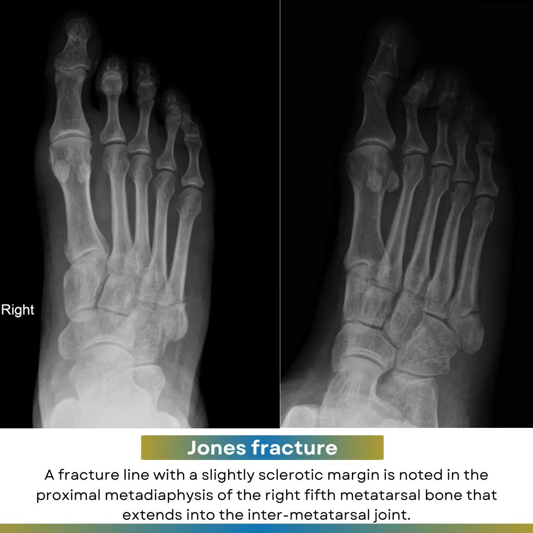 Orthopaedic Tutorials tweet media